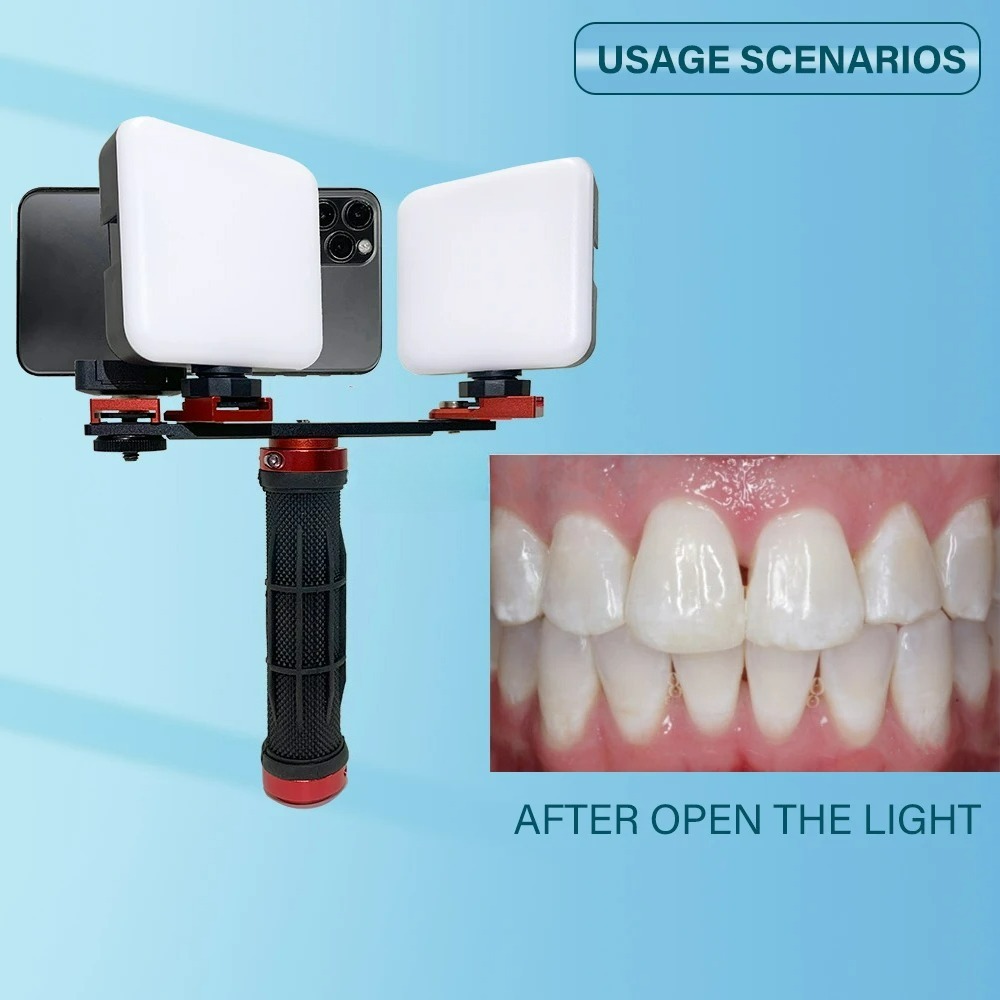 Dental Photography Light Phone - Photography Dental recension och pris
