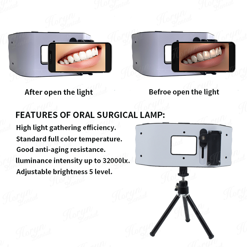 Dental Flash Light Photography - Photography Dental recension och pris