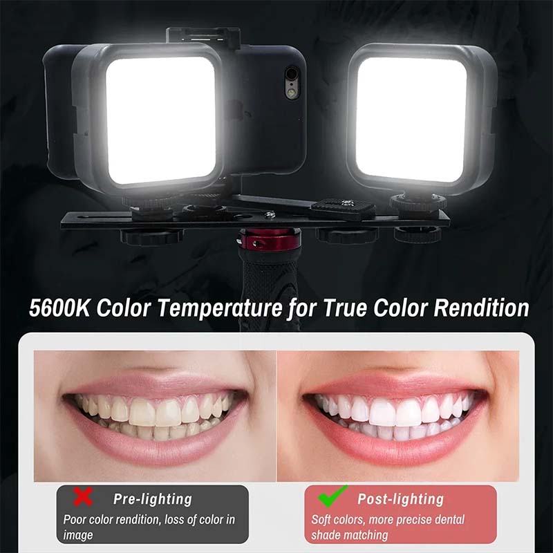 Dental Photography Light With  - Photography Dental recension och pris